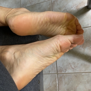 Foot Heel Bruise - Photos - Lelu Love - Personal Porn